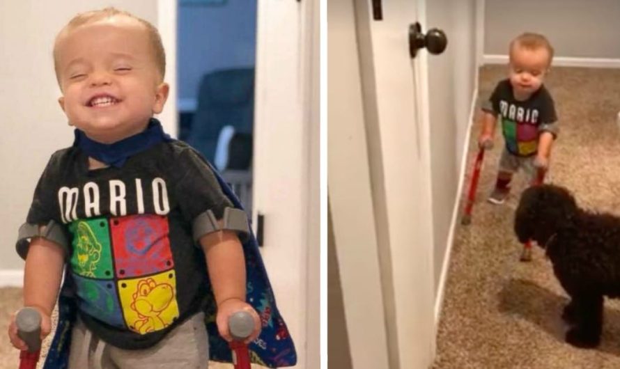 Toddler with birth defect melts hearts after showing his dog he can walk