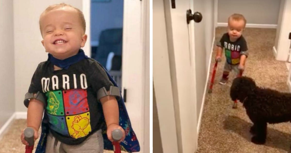 Toddler with birth defect melts hearts after showing his dog he can walk