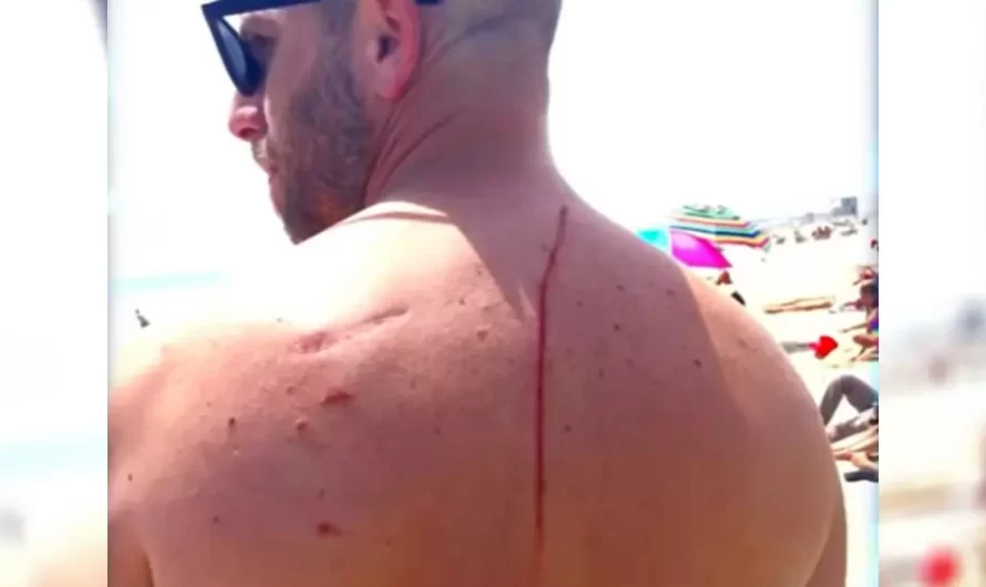 Man Credits ‘Shark Attack’ For Saving His Life From Cancer
